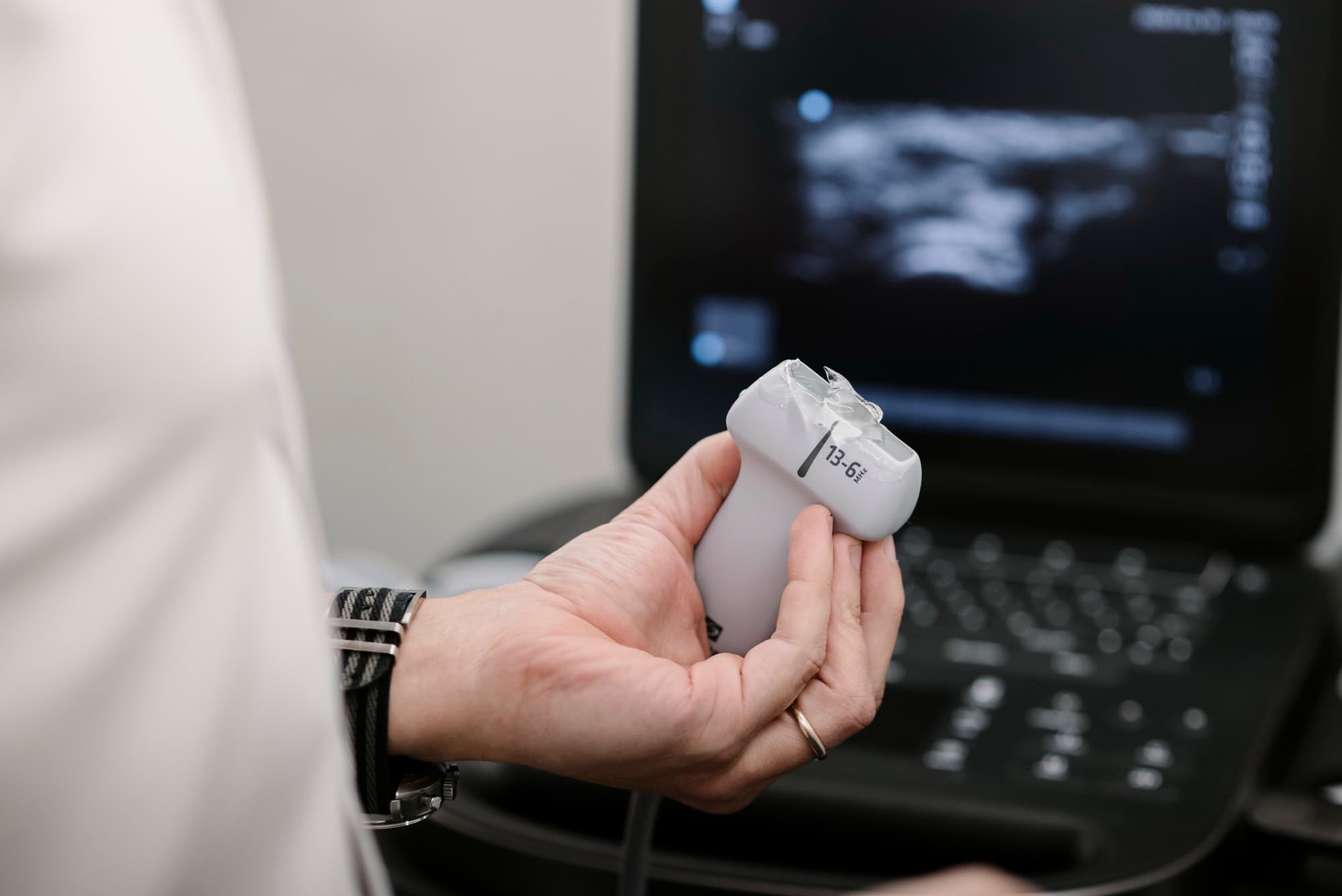 Transdutor de ultrassonografia point-of-care utilizado durante o exame físico, medicina da dor em Belo Horizonte